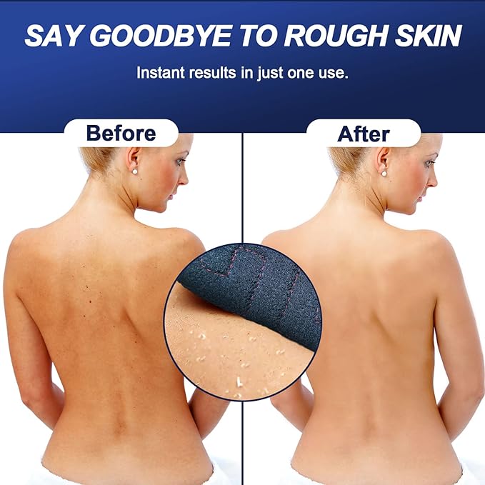 Exfoliating Back Scrubber for Shower, 38 Inches Long Back Exfoliator with Two Handles for Men and Women Acne, Double-Sided Bath Back Washer Body Cleaner to Scrub Your Skin