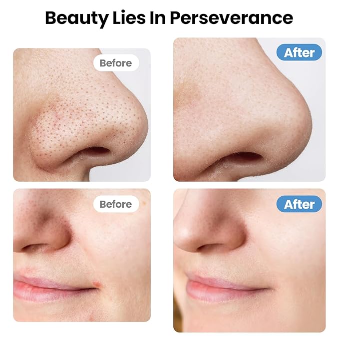 UNIWA Skin Scrubber Face Spatula, Skin Scrubber Pore Cleaner Blackhead Remover Tool for Deep Facial Cleansing - 4 Modes, Face Spatula with USB Charger, LCD Display, IPX7 Waterproof -Pink