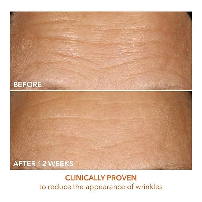 Dr Dennis Gross Vitamin C Lactic 15% Firm & Brighten Serum: Visibly Improve Signs of Aging, 1 oz