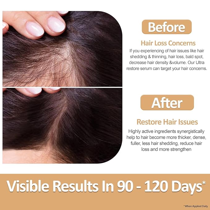 Ultra Restore Hair Growth Serum -Promote Fuller Hair Growth and Reduce Hair Loss, Nurtures Hair Follicle, Hydrates the Scalp, Detox Scalp -Stem Cells, Ashwagandha, Biotin, Keratin