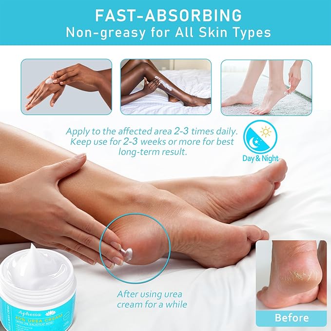 Urea Cream 40 Percent For Feet Maximum Strength - plus Salicylic Acid 2% Foot Cream For Dry Cracked Heels Feet Knees - Dead Skin Cuticle Callus Remover Toenail Softener - Lightly Camellia Scent