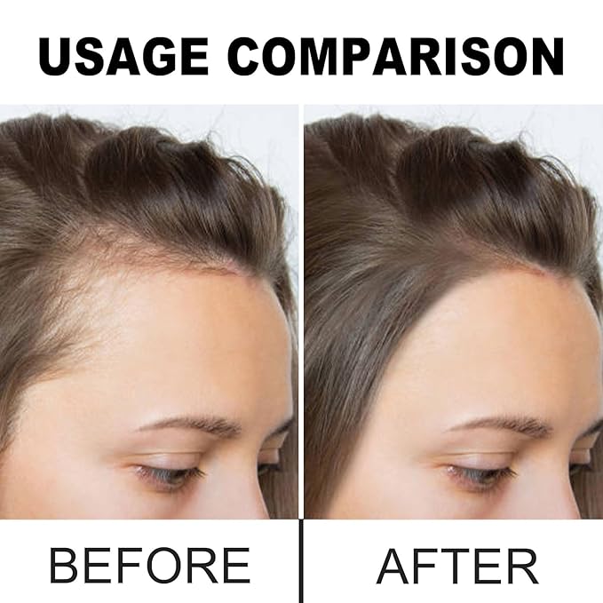 Batana Oil for Hair Growth - 100% Pure & Natural from Honduras, Batana Miracle Hair Loss Oil, Repairs Damaged Hair, For Thicker, Stronger Hair, 4.oz (1pcs)