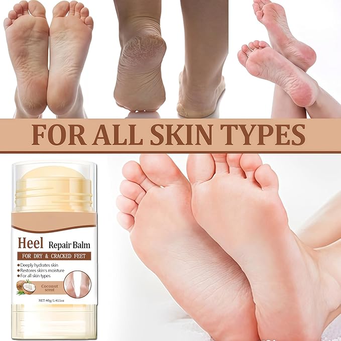 2Pcs Coconut Foot Balm Stick, Moisturizing Foot Stick for Dry Cracked Heels, Hand Elbow and Knee Balm, Nourishing Heel Care for Women and Men, Portable Travel Moisturizer