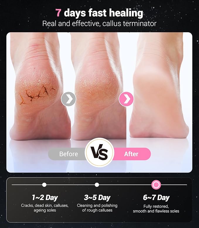 5-in-1 Professional Electric Callus Remover for Feet(Portable & Foldable), Removes 99.92% of Calluses in 3 Mins, Eectric Foot Callus Remover Pedicure Kits with 10 & 40 Grit Pads for Smooth Feet, Pink
