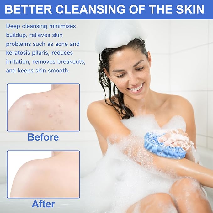 Metene 2 Pack Silicone Exfoliating Body Scrubber with Loop, Body Scrubber for Men and Women, Silicone Loofah for Shower, Soft Silicone for Shower and Bath Skincare Routine(Blue)