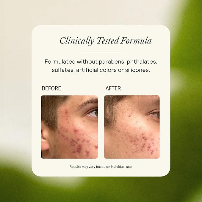 EQ Gentle Cleanser - EGCG + Quercetin - Gentle Face Wash - Cleanse & Purify Skin - For Redness & Blemishes - With Squalene Oil - Lightweight Plant-Based Formula - 4.05 fl oz