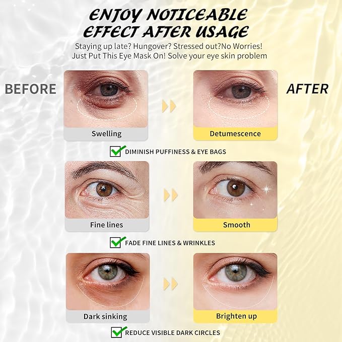 Under Eye Patches Variety Pack (48 Pairs), Stocking Stuffers for Women, Eye Masks for Dark Circles Puffy Eyes With 8 Colors (6 Pairs/Color), Vegan Skin Care Gifts for Teen Girls