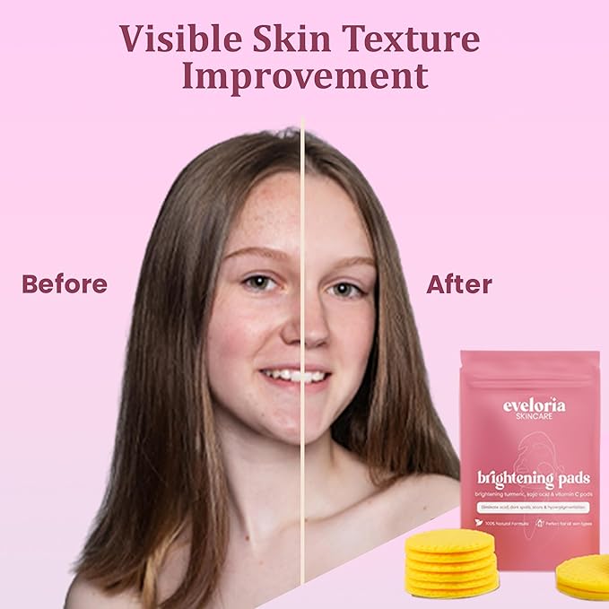 Eveloria™ Brightening Turmeric & Kojic Acid 30 Face Pads – Gentle Exfoliating & Cleansing Pads for Dark Spots, Uneven Tone & Dull Skin – Natural Glow with Turmeric, Kojic Acid & Vitamin C