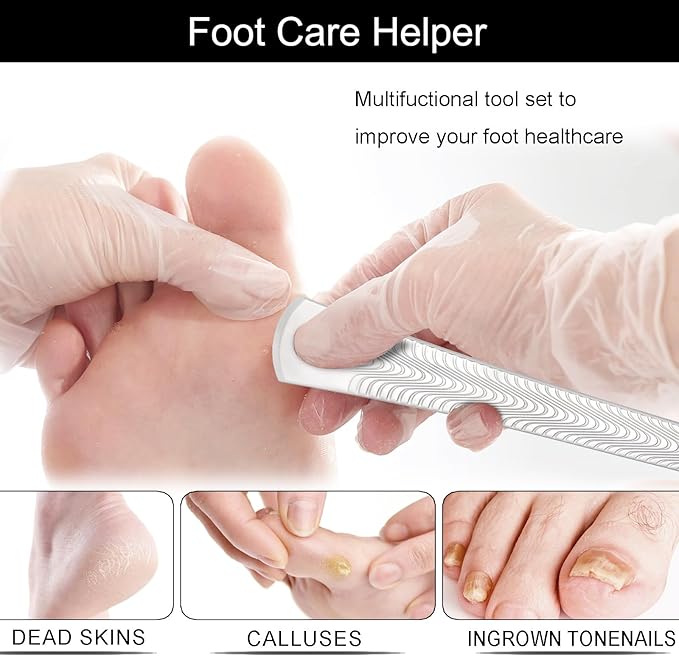 Segbeauty 5pcs Professional Ingrown Toenail Removal Kit with 1000 Grit Whetstone, Dead Skin Foot Scraper for Callus Removal, Home Foot Care Nail Cuticle Pedicure Kit, Stainless Steel Nail Knife Blade