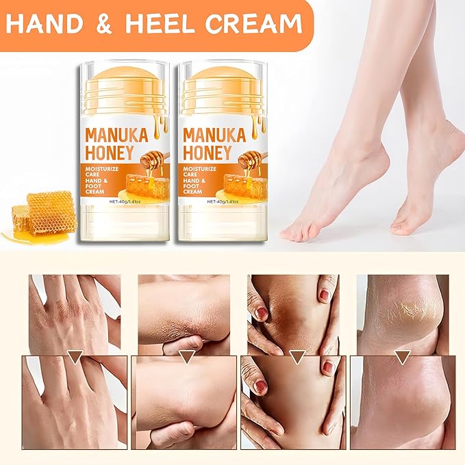 2pcs Cracked Heel Stick Balm, Manuka Honey Heel Stick For Cracked Feet, Foot Cream For Calluses and Dry Feet, Cracked Foot, Manuka Honey Hand Cream