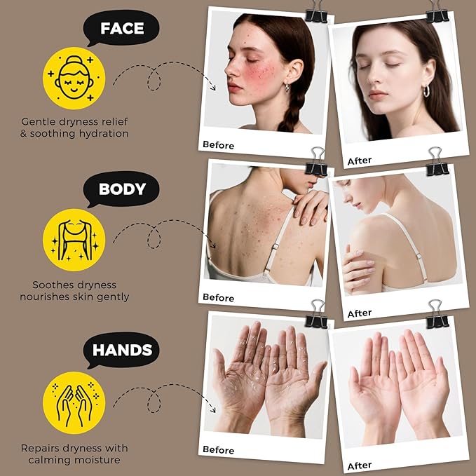 4.2 OZ Beef Tallow for Skin Face, Grass Fed Beef Tallow with Honey Bee Venom Cream Natural Tallow and Honey Balm, Deep Hydration Tallow Face Moisturizer for Dry, Sensitive & All Skin Types