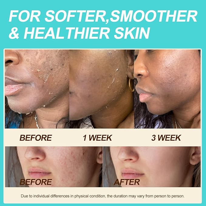 Beef Tallow for Skin - 100% Grass Fed - Whipped Tallow and Honey Balm，Moisturizer Cream for Face & Body -Natural Organic Formula for Dry & Sensitive Skin (Citrus Breeze) (2 oz)