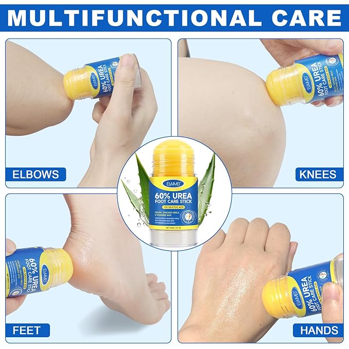 Urea Cream Stick 60% plus Salicylic Acid 2%,Maximum Strength Urea Foot Cream,Foot Cream Moisturizer for Dry Cracked Feet,Deeply Moisturising and Fast Absorbing Gentle Exfoliation 1.4oz
