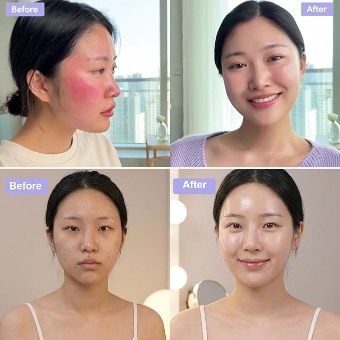 Madecassoside Sheet Mask Blemish Repair, Collagen Face Mask- Hyaluronic Acid, Niacinamide, Panthenol, Centella Facial Masks for Sooth, Hydration, Firming, Korean Skin Care, Stocking Stuffers 5ea