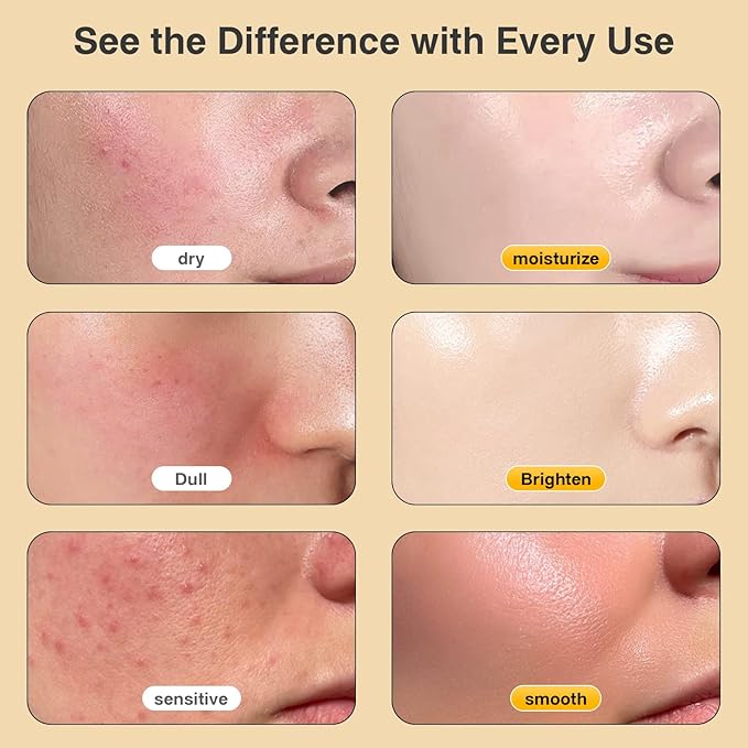 Beef Tallow Honey Balm for Skin,Face,Body - Handmade Whipped Cream Face Moisturizer with 100% Narural Organic Grass-Fed Beef Tallow & Raw Honey - Balm For Dry, Sensitive Skin - Unscented,4.23OZ