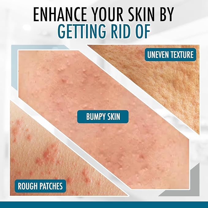 GLY MIRACLE Moisturizing Body Cream Lotion, 12 ounce - Non-Greasy Skin Humectant for Extremely Dry Skin, Hands, Body, and Feet, Light Fresh Scent with Pure Glycerin for Nourishing Hydration.