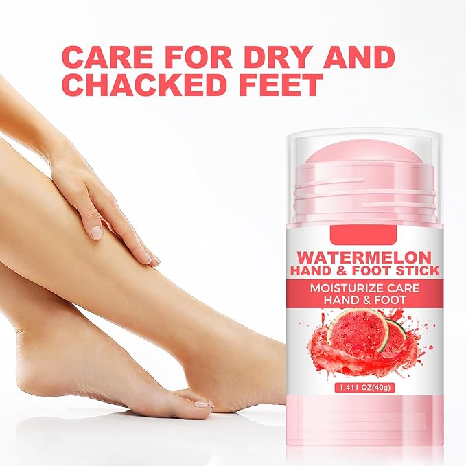 60% Urea Cream Foot Hand Cream Stick for Cracked Hands Elbows Feet Knees, Balm for Dry & Dead Skin, Hydrates & Nourish Foot Care for Women & Men, Watermelon Scent, 1.41 oz