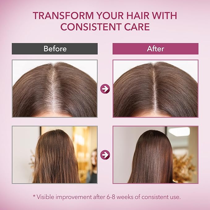 Onion & Biotin Hair Growth Shampoo: Rosemary Infused Shampoo for Hair Loss and Thinning Hair - Promotes Healthier, Thicker and Stronger Hair for Women and Men