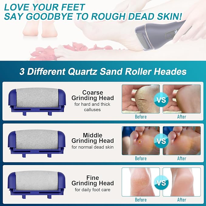 Electric Callus Remover for Feet Rechargeable Portable Electronic Foot File Pedicure Tools 16 in 1 Foot Callus Remover Kit Foot Scrubber to Remove Dead Skin (Blue)