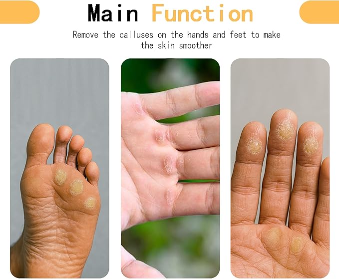 Callus Remover for Hands,Hands & Feet Callus File with 3 Grit Sandpapers (100/180/400), Durable Hand Callus Shaver for Crossfit, Climbing, Woodworking,Rock Climbing Gifts