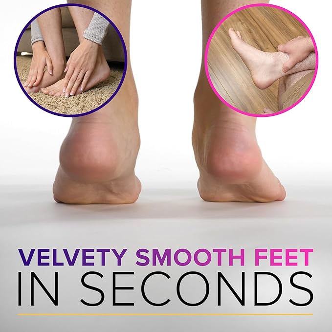 RUSTPROOF Foot File Callus Remover for Feet with Skin Catcher (XL Size) NYK1 MEGAFILE Foot Callus Remover for Wet & Dry Use - High-Performance Feet Scrubber with Textured Grip for Non-Slip Control