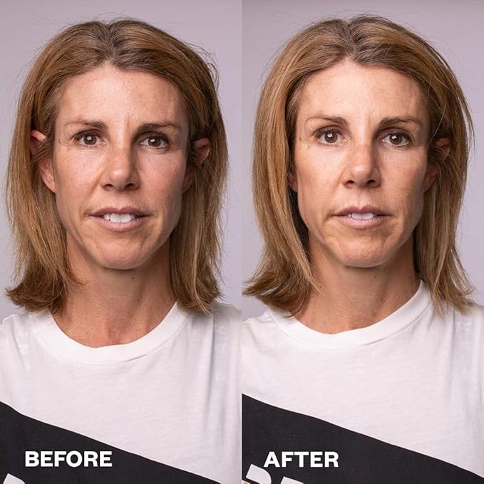 Wrinkles Schminkles Face, Neck & Décolletage Polishing Peel Pads, Skin Exfoliating & Resurfacing, Pack of 5 Towelettes