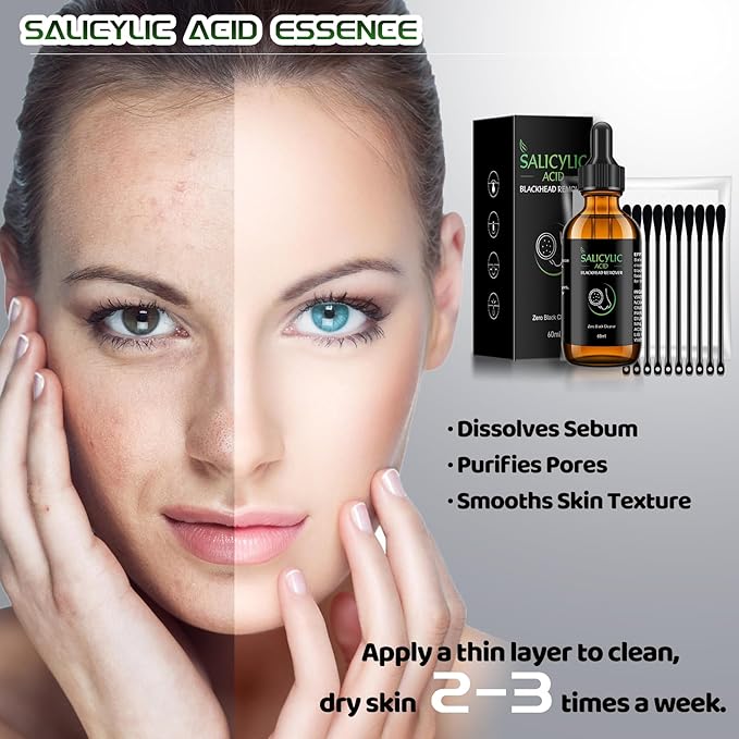 Salicylic Acid Serum, 60ml Blackhead Remover Essence and 25 Pcs Nose Pore Strips, Deep Cleansing Dirts, Pores, Skin Oil, Purifying Peeling, Black White Head Acne Removal for All Skin Type