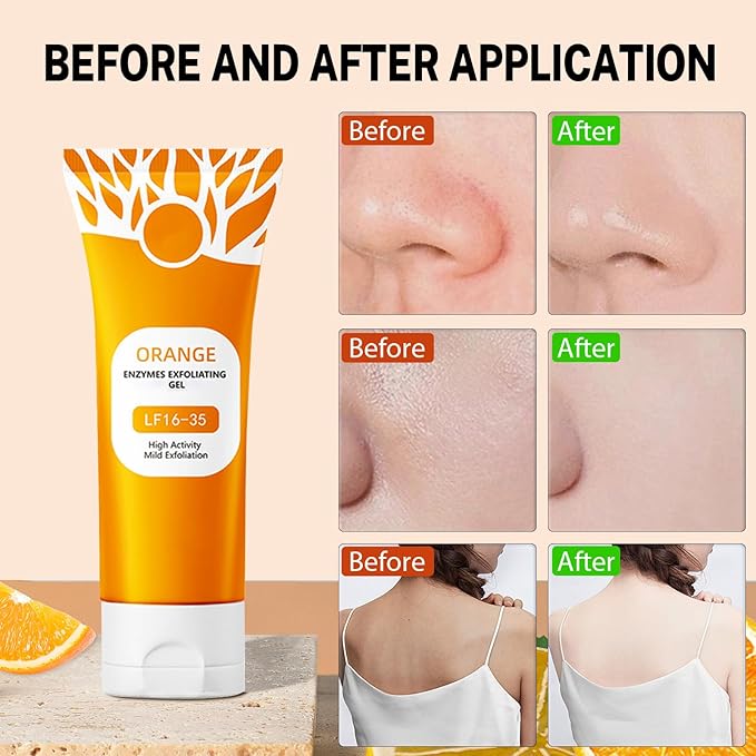 3Pcs Orange Exfoliating Gel for Face & Body, Orange Enzymes Exfoliatings Gels, Upgraded Deep Pore Oranges Peeling Scrub, Moisturize Cleansing Skin for All Types Skin
