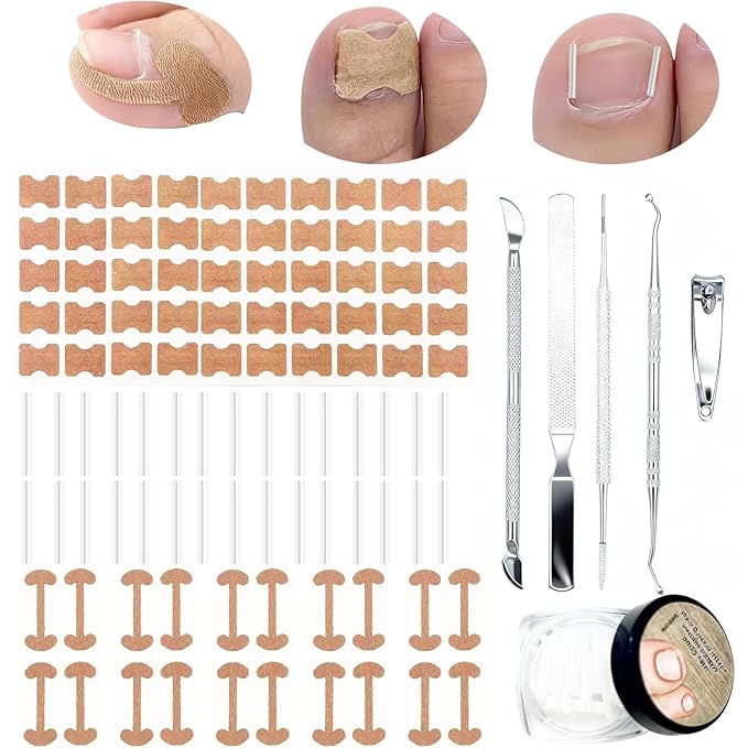 Ingrown Toenail Treatment,Professional Ingrown Toenail Removal Kit,Home Care Nail Clipper Set Suitable for Foot Care Repair
