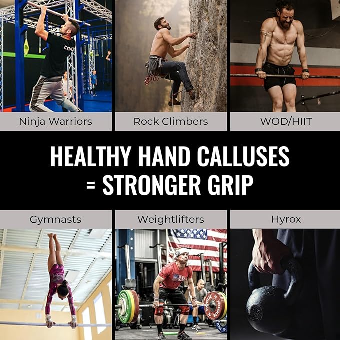 SandBar Ultimate Callus Remover Set - 4" & 8" Files with Moisturizing Salve Balm Stick - Elevating Athletes, Weightlifters & Rock Climbers for Smoother Hands & Feet - Gold (Black) (Gold Bundle)