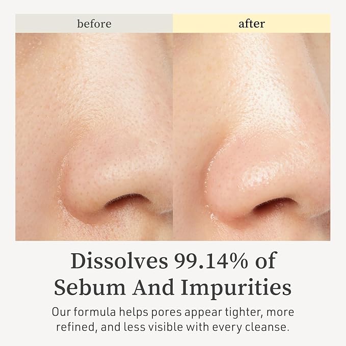 NOONI Korean Cleansing Oil - Snow Aqua 0 LHA Toning Cleansing Oil | Makeup Blackhead Remover, Pore Control, Glass Skin, Help Control Sebum, Revitalizing, Moisturizing, Gifts For Women, 6.76 Fl Oz