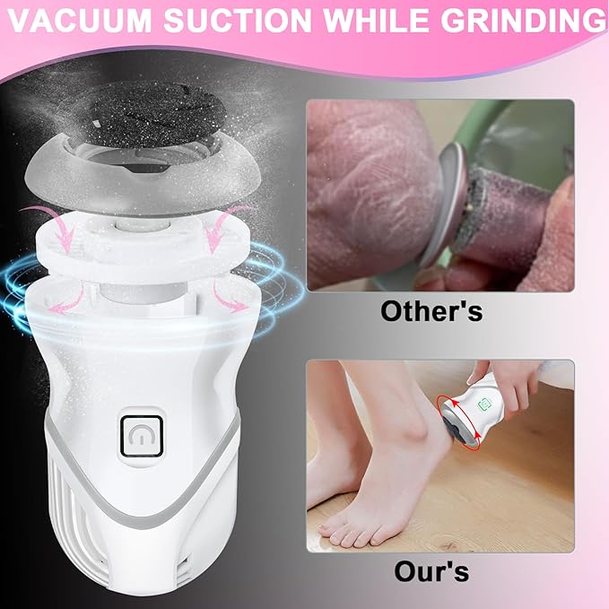 Electric Foot Callus Remover for Women Men, Rechargeable Electric Foot File Pedicure Tool with 2 Speeds and 6 Grinding Heads, Portable Feet Grinder for Cracked Dry Heels Dead Skin Calluses