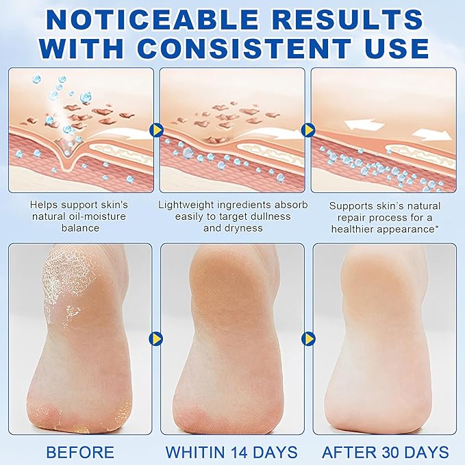 2 Pcs 60% Urea with 2% Salicylic Acid Foot Care Stick, Urea Foot Cream for Cracked Feet, Repairs Dry Rough Heels Fast, Foot Lotion Moisturizer for Dead Skin, Hydrating Heel Balm