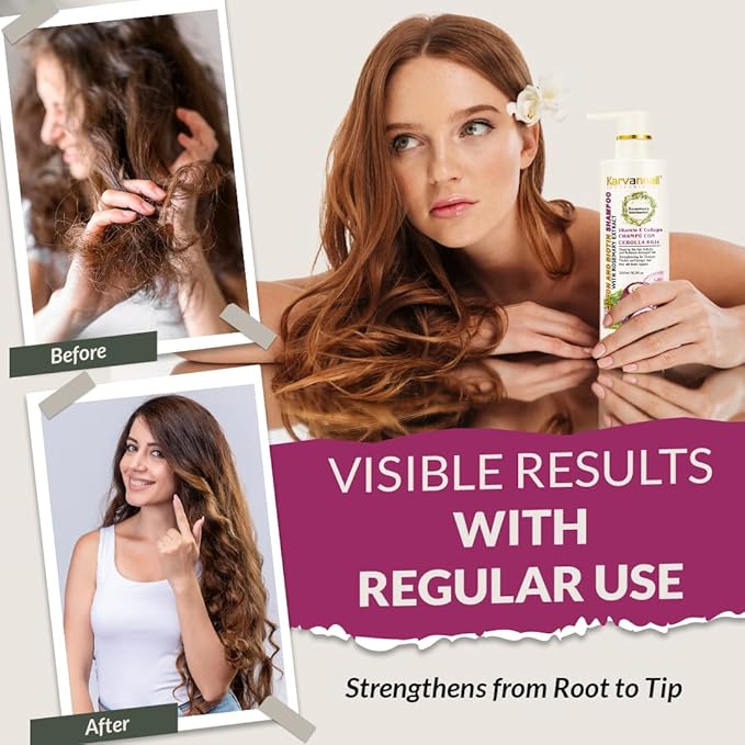 Rosemary Biotin Shampoo & Hair Mask Set | Onion Extract, Collagen & Vitamin E Anti-Thining, Anti-Hairfall Shampoo and Deep Conditioner Set for Dry, Damaged Hair, Sulfate & Paraben Free 2 x 16.9 fl oz