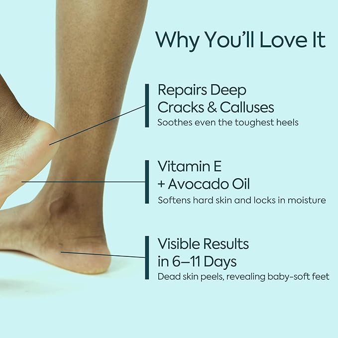 Foot Moisturizing Cream – Hydrating Heel & Foot Cream with Vitamin E and Avocado Oil – Softens Dry, Rough Skin – Nourishing Daily Foot Care, 100 ml