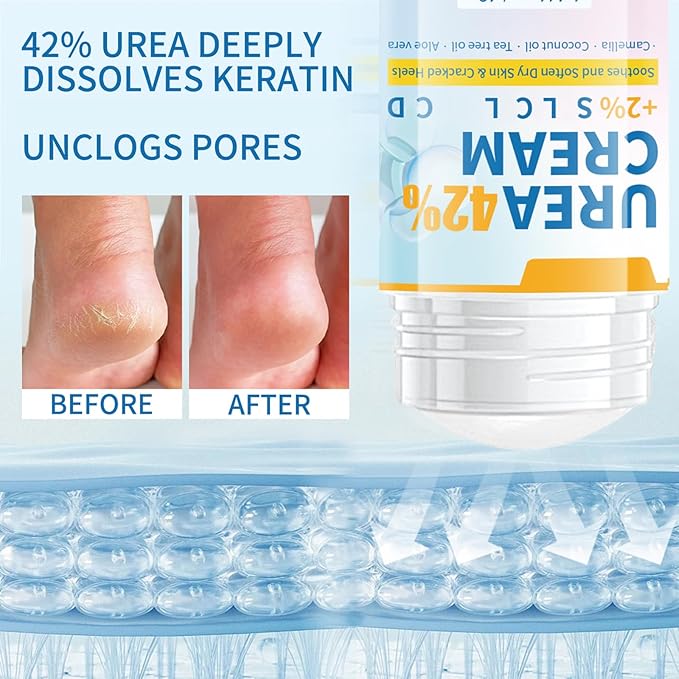 Urea Cream 42 Percent for Feet Maximum Strength - 2Pcs Hydrating Foot Stick Heel Balm for Smooth Skin- Foot Lotion Balm for Dry Rough Cracked Hands Knee Elbow Heel Stick for Women Men - 1.41oz / 40g