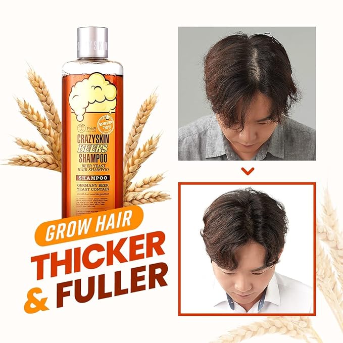 CRAZY SKIN German Beer Yeast Biotin Shampoo & Hair Treatment Set for Anti Hair Loss & Hair Regrowth, Shiny Curl Care 300ml + 200ml Set (16.9Fl oz)