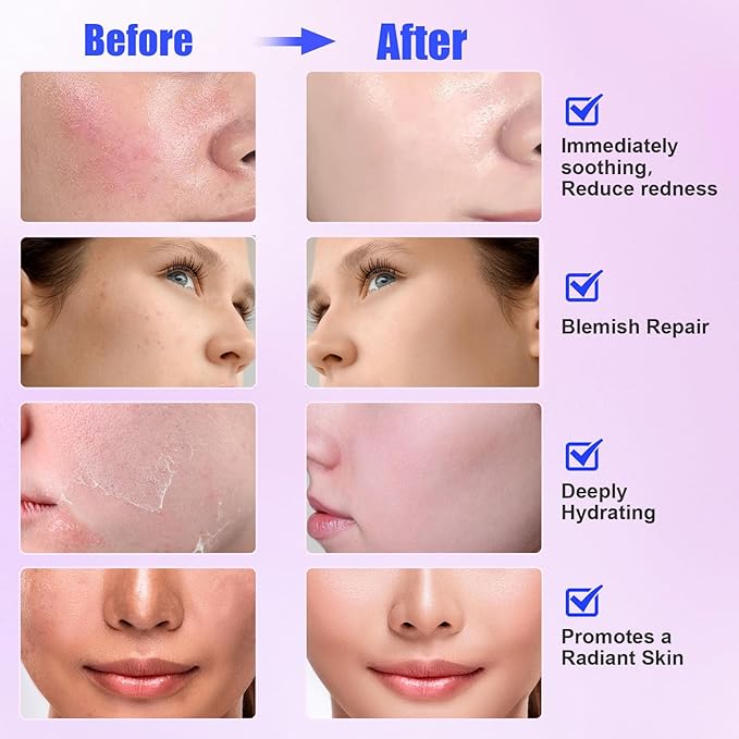 Madecassoside Sheet Mask Blemish Repair, Collagen Face Mask- Hyaluronic Acid, Niacinamide, Panthenol, Centella Facial Masks for Sooth, Hydration, Firming, Korean Skin Care, Stocking Stuffers 10ea