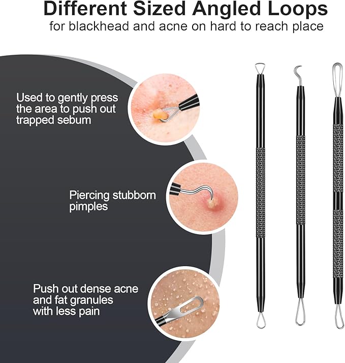 6PCS Blackhead Remover Comedone Extrator Kit, Pimple Extractor Acne Removal Tool Kit, Curved Blackhead Tweezers Kit, Comes with Alcohol Tablets and Magnifying Glasses for Blemish Removal (Iron Box)