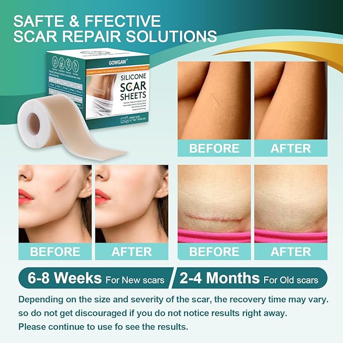 Medical Grade Silicone Scar Sheets, Silicone Scar Tape (1.6”x 60” Roll-1.5M), Professional Scar Removal Treatment, Reusable Silicone Scar Strip for Keloid, C-Section, Surgery, Burns, Acne Etc