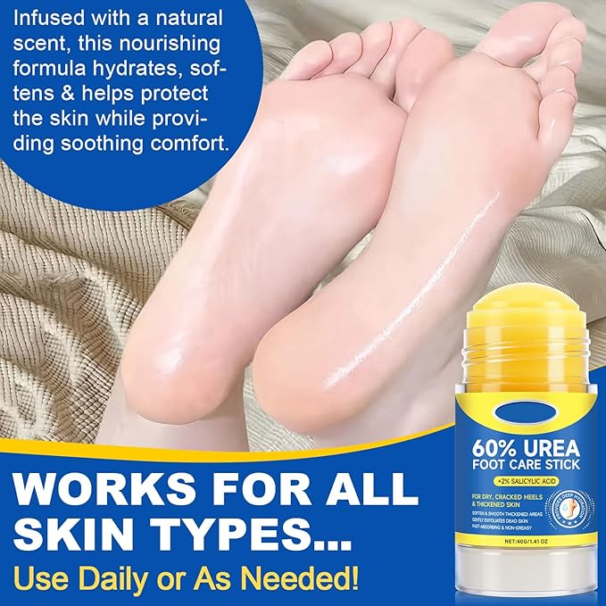 60% Urea Foot Cream Stick with 2% Salicylic Acid, Extra-Strength Cracked Heel Repair for Dry Feet & Calluses, Moisturizing Urea Cream Stick for Dead Skin Removal, Heel Balm for Rough Skin(2pcs)