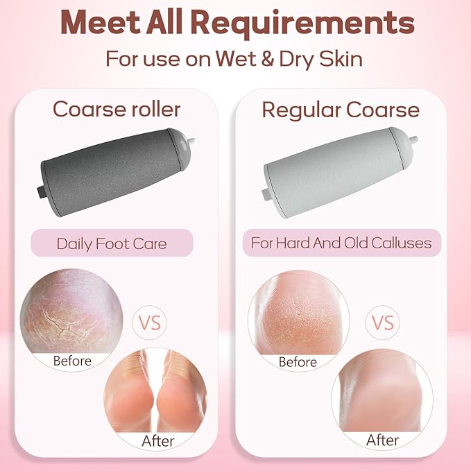 Callus Remover for Feet, ZABOUL Electric Foot Callus Remover Rechargeable Pedicure Tools Smooth Pedicure Wand Electronic Foot File, Feet Care for Removes Dry Hard & Dead Skin Ideal Gift