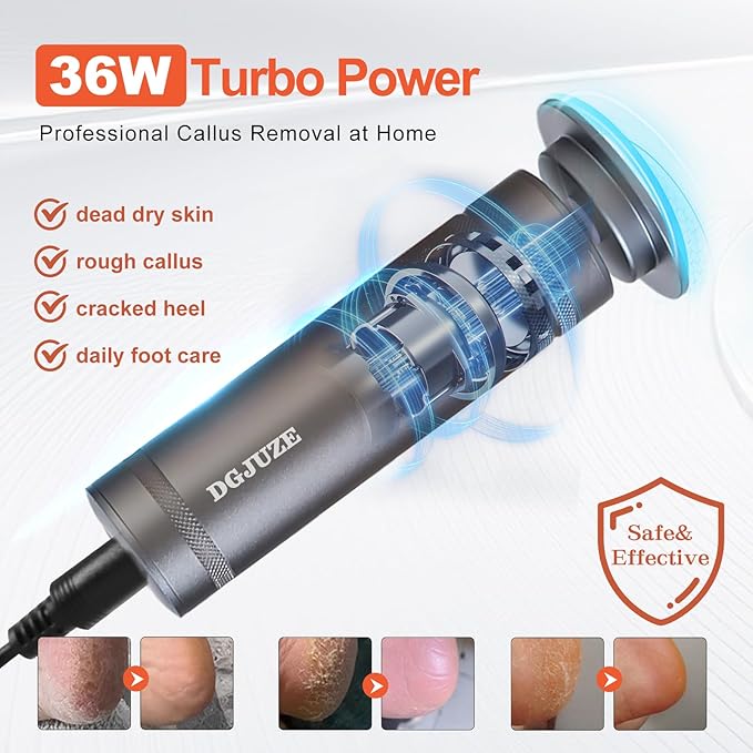 PowerPro Electric Foot Callus Remover,36W Professional 1200rpm Adjustable Speed Metal Body Heavy Duty Grinder for Dead Skin,Automatic Foot Sander with 60pcs Sandpaper Pads(Grey)