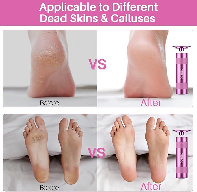 Electric Foot Callus Remover, 2-in-1 Electric Foot Filer/Nail Filer, Callus Remover for Feet with 60Pcs+12Pcs Sandpaper Discs，Holiday Gift Foot Repair Tool, Pink