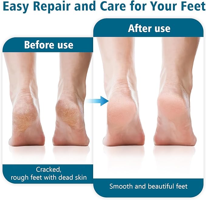 Foot Brush for Shower with Handle 2 in 1,Ooloveminso Large Foot Pumice Stone Brush Scrubber Foot File Calluses Remove Suitable for Horniness Foot Spa,Foot Care Smooth Skin (Blue)