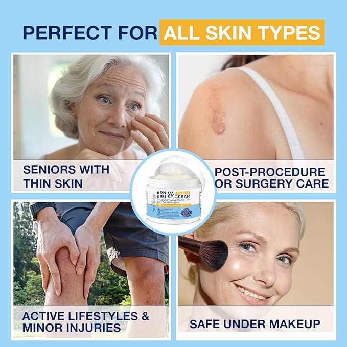 Arnica Bruise Cream Extra Strength – Fast-Acting Arnica Montana with Vitamins K, C & E for Bruising, Swelling, Discoloration & Thin Skin – Hydrating Moisturizer for Face & Body – 4 oz