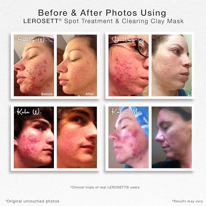 LEROSETT Facial Clay Mask for Balanced, Clear-Looking Skin. Helps Refine Pores & Reduce Excess Oil. 100% Natural, Spa-Grade, Made in Sweden Since 1987