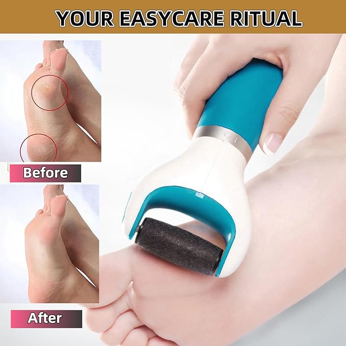 Electric Callus Remover for Feet Callus Remover Foot Callus Remover Tool Foot Buffer Electric Foot Calloused Feet Remover Tool Pedicure Supplies USB Charging and Battery Power (Blue)