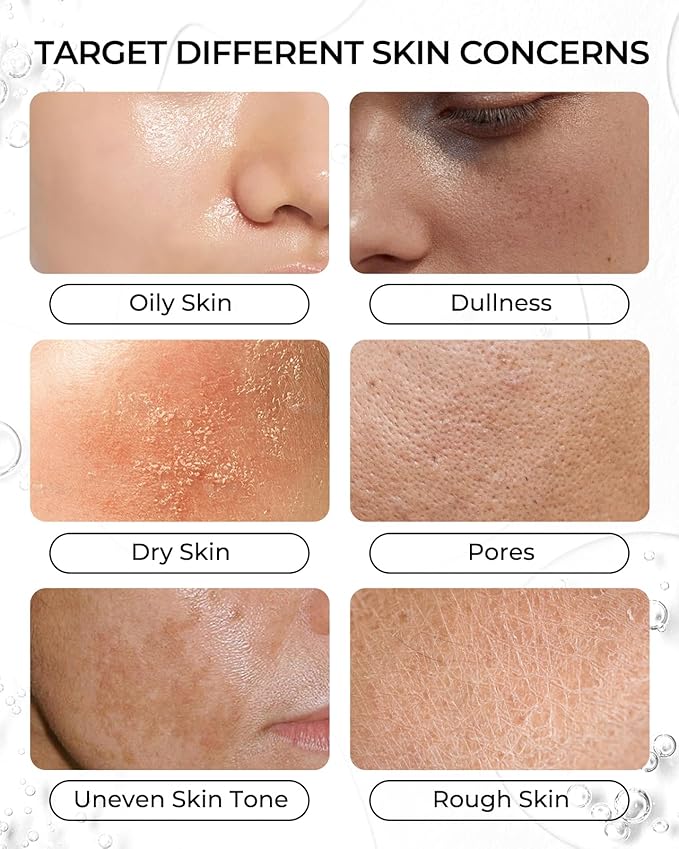 6 Sheet Masks Kojic Acid Turmeric Face Mask Even Skin Tone, Elasticity, Radiant, Moisturizing, Hydrating Face Masks for Dull Skin Facial Mask Controlling Oil and Refining Pores Facemask Skincare