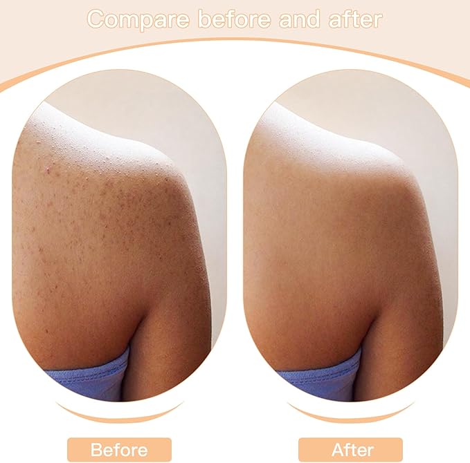 2 Pack Exfoliating Body Brushes - Wet & Dry Brush - Shower Scrubber for Body, Dry Brushing Body Brush for Lymphatic Drainage, Body Exfoliating Brush with Massage Nodes